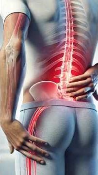 Sciatica Nerve Pain? 😱 Find Out If It’s L4-L5 or L5-S1! ✅ #Shorts