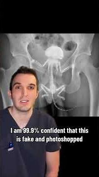 Gerbilling 🐹 #medicine #xray #doctorlife #doctor #medschool #gerbil