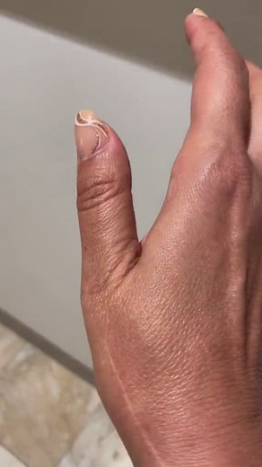 Understanding Involuntary Finger Twitching Causes