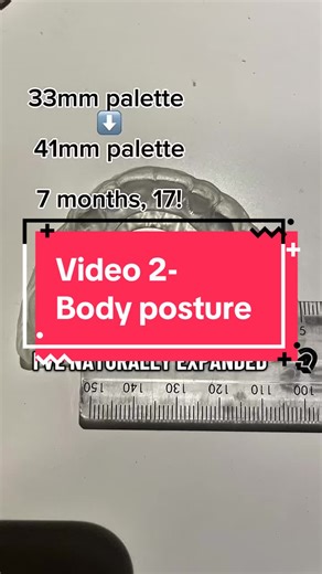 Absolutely MASSIVE topic, took me ages hope you guys enjoy! #airway #airwayhealth #orthodontist #fyp #dentist