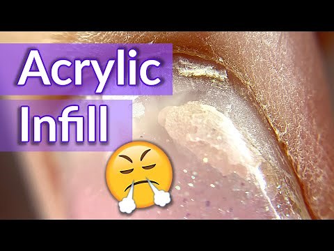 Fast Acrylic Fill Tutorial
