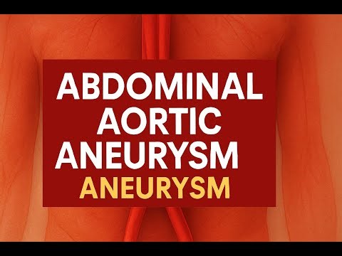 Abdominal Aortic Aneurysm (AAA) EXPLAINED: The Silent Killer You Might Be Ignoring! 🚨 Must Watch!