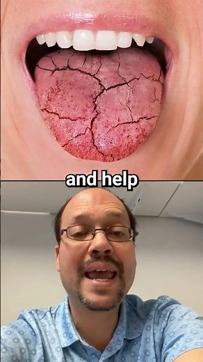 Dry Mouth Symptom Of Kidney Disease, And The Fix!