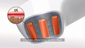 3.7K views · 18 reactions | Curious about the Titan? How does it work? Let us show you! | Silk'n | Facebook