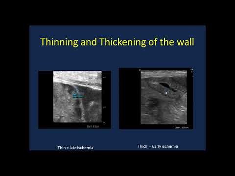 Point of Care Neonatal Ultrasound