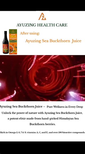 Integration of Ayurveda with Modern Medicine : how Ayurvedic and allopathic approaches can complement each other in chronic disease management. Evidence-Based Validation of Ayurvedic Formulations — bridging traditional knowledge with modern clinical trials. Ex delivery --🚛 Quality assurance Secure payments etc join with us www.ayuzing.com for more details 91 6301612248 | Health Care business Opportunity