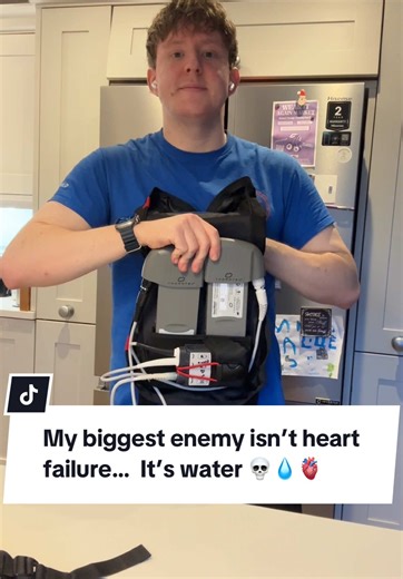 Living with LVAD: The Challenges of Heart Support