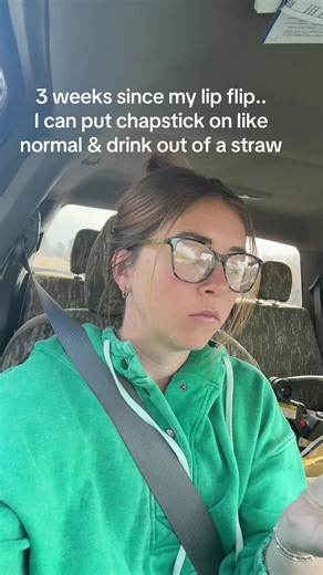 Lip Flip Experience: Three Weeks Later