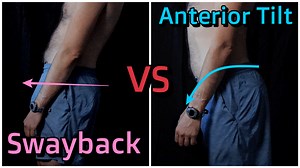Anterior Pelvic Tilt vs Swayback – What’s the Difference?