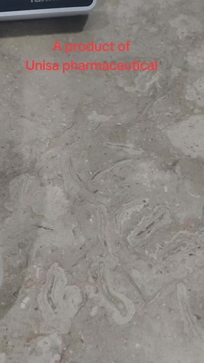 Impurities in Ringer solution #ivfluids #drip #dripcheck #ringerlactate #ringer #unisol #pharmaceutical #fluids #sterilwwater