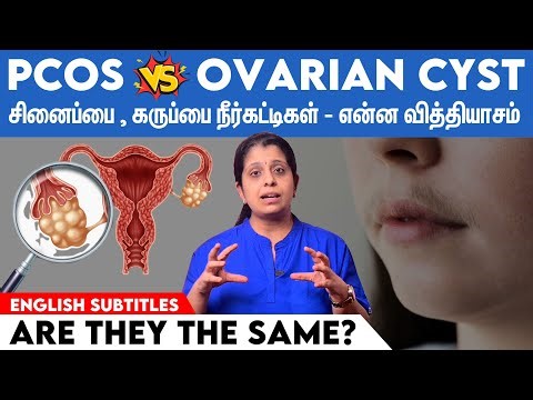 PCOS vs Ovarian cyst - Are they the same? கருப்பை மற்றும் சினைப்பை நீர்கட்டிக்கும் என்ன வித்தியாசம்?