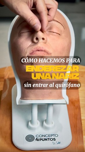 65K views · 382 reactions | Cómo mejorar un desvío nasal . Con la...