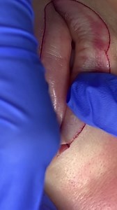 19 reactions | Natural lip tattoo, or lip blushing, is a non-invasive procedure that enhances lip color and shape using organic pigments. It creates a subtle tint, giving a naturally flushed look, defining the lip contour and adding a touch of color for a youthful appearance. Unlike traditional lip tattoos, it aims for a soft and natural effect, complementing your features without looking too artificial. | Be Brows | Facebook