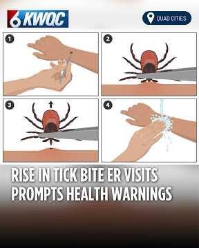 Rise in Tick Bite ER Visits Prompts Health Warnings