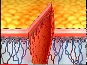 Phases of Wound Healing- Part 1