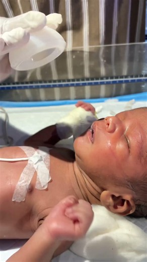 Newborn baby being chesthryp 😊👍 #youtubeshorts #viralshorts #trending #video #nursing #sacribe