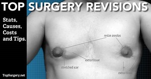 Top Surgery Revisions: Causes, Costs and Considerations