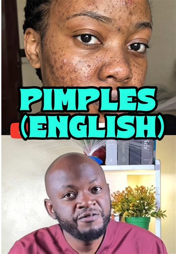 Pimples explained #pimple #pimples #pimplepop #acne #viralvideo