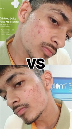 Plum Vs The Derma Co Moisturizer | Which One Should You Buy?