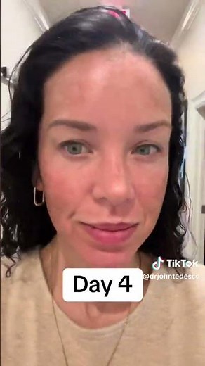 Bre's 6-Day CO2 Laser Recovery Journey | Real Results & Progress