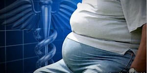 Added risk with COVID-19 for people with obesity