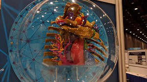 Mayo Clinic Minute: How 3-D imaging helps doctors and patients - Mayo Clinic News Network