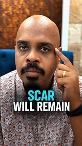 THIS SCAR WILL BECOME A LESSON # #motivation #reenukumar