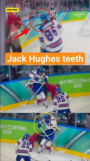 Jack Hughes Lost His TEETH for Olympic Gold #JackHughes#WinterOlympics #shorts #viral #trending