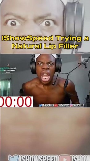 Throwback of IShowSpeed Trying Viral Lip Filler — Goes Hilariously Wrong!