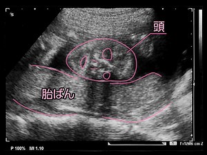 妊娠22週 エコー写真で見る胎児の大きさ・胎動・「22週の壁」とは [妊娠中期] All About