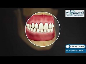 Anatomy of the Incisors | Structure, Function & Clinical Importance Explained