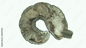 Parasitic worm Echinorhynchus gadi under microscope, phylum Acanthocephala. Eversible proboscis are visible with which they pierce intestines of their host. White sea