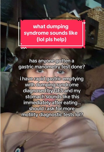 at its best, i get 2ish hours after eating for this process to happen in, but at worst the whole thing can happen in 30-45 minutes:/ NO WONDER ive got absorbtion issues man😅 hyperperistalsis and excessive borborygmi after eating is one of the RGE symptoms i deal with MOST and its SO ANNOYING 😭 im wondering if i should persue getting this “timeline” of emptying that im feeling looked into more?? it could help me determine whether my RGE is neurogenic (caused by the brain/CNS forcing contaction 