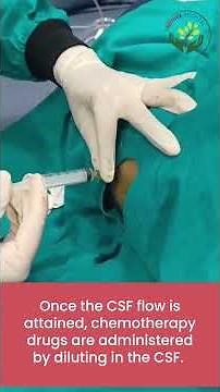 intrathecal chemotherapy procedure #chemotherapy #cancertreatment #procedure #nurturehospital