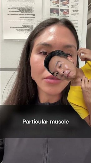 Why your jaw bulges after Masseter Botox