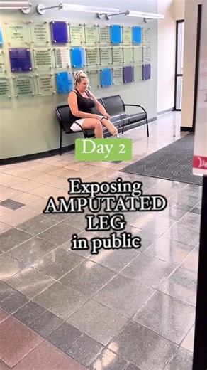 if i can figure out what this fear is based in, maybe i can remove it from the root. Im starting to understand that its not other people im afraid of. But thats as far as ive gotten. If you need help with elective amputation, ive got you! Check out my Stan.Store #Electiveamputation #electiveamputee #amputeelife #amputationstory #amputee #painchangedme #thestrengthinourscars #godknowsmystrugglesohesentme #chronicpain | Kerri Trammel