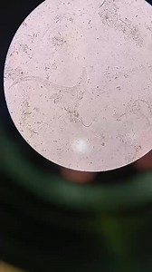 Stool sample prepared by @Prabesh Silwal. #lablife #microbiology #microscope | Lab life