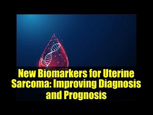 New Biomarkers for Uterine Sarcoma: Improving Diagnosis and Prognosis