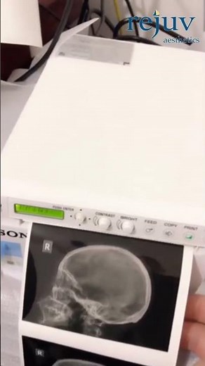 Sony Ultrasound Printer UP X898 MD