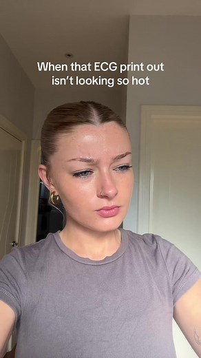 Identifying Abnormal ECG Patterns in Athletes