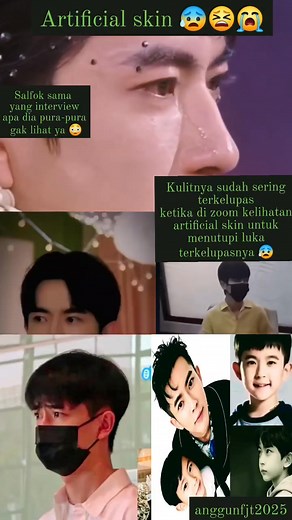 1.6K views · 2K reactions | Kulitnya sudah sering d!k3lup451n dan ditutupi pakai artificial skin setiap kali ada TV show atau performance  crews dan make up artisnya pasti sudah lama tahu kondisi tidak biasa yang Yu alami  #JusticeForYuMenglong #yumenglong于朦胧 #justiceforalanyu #dracinlovers #chineseactor #dramacina #China #JusticeForAll | Farel Anggun Troup | Facebook