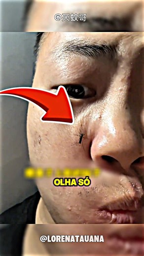 O Experimento Mais Estranho Com Um Mosquito #shorts