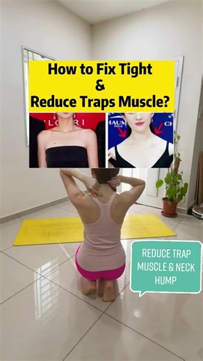 Reduce Tight Trapezius Muscles: Neck Hump Fix