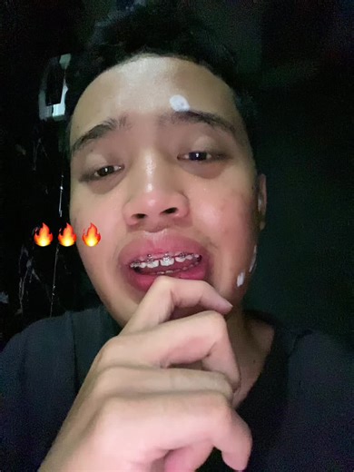 Exploring the Different Types of Fire APIs