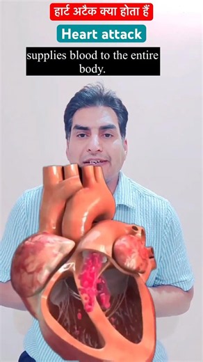 Heart attack क्या होता हैं 💔 #ecg #angina #shorts