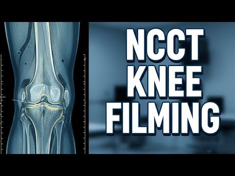 NCCT Knee Filming | Knee Joint Imaging Explained | Radiology Tutorial
