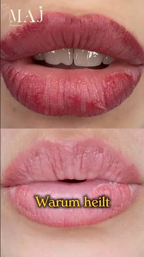 Lips Permanent Make Up - Vorher / Nachher von MAJ Permanent in München 👄