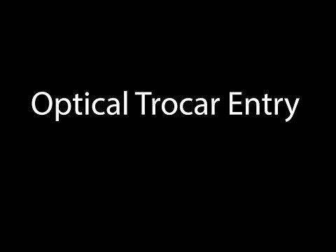 Direct Optical Trocar (Optiview) Access of the Abdomen for Laparoscopy