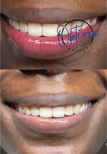 🚀 Devenez une experte en beauté avec notre formation 4 en 1 ! ✨ Maîtrisez lamination des sourcils, extensions de cils, micropigmentation des sourcils et des lèvres en seulement 3 jours ! 🔥 📍 Prochaines sessions : 📅 Port-au-Prince : 8-10 avril | 11-13 avril 2025 📅 Mirebalais : 20-22 avril 2025 📅 Cap-Haïtien : 23-25 avril 2025 📅 Gonaïves : 26-28 avril 2025 💰 Inscription : 5,000 Gdes 💵 Participation : 19,000 Gdes 📞 Réservez votre place maintenant ! (509) 41 15 3650 / (509) 37 87 4697 #For