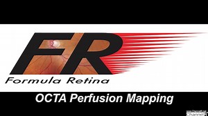 OCTA Perfusion Mapping - Eyetube